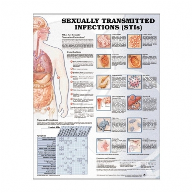 Plakatas "Lytiškai plintančios infekcijos"